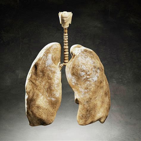 smoker s lungs photograph by sciepro science photo library