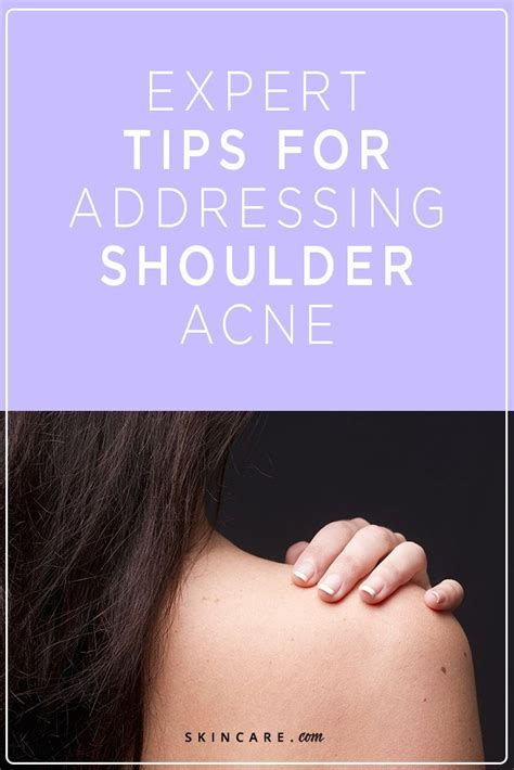 How To Get Rid Of Shoulder Acne By Loréal Shoulder