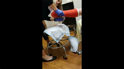 New Cast Post Op Ankle Surgery Youtube