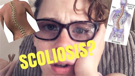 Scoliosis Surgery Vlog Youtube