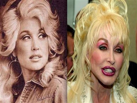 10 Worst Celebrity Plastic Surgery Mishaps in USA - Home Decor