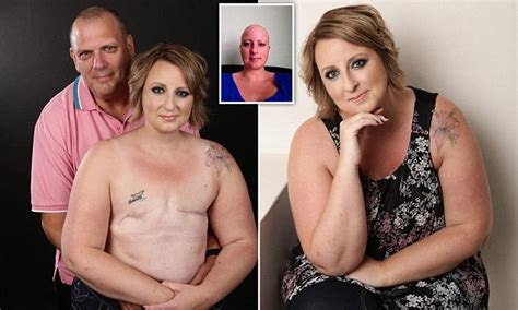 Breast Cancer Survivor Poses Topless After Double Mastectomy Daily Mail Online