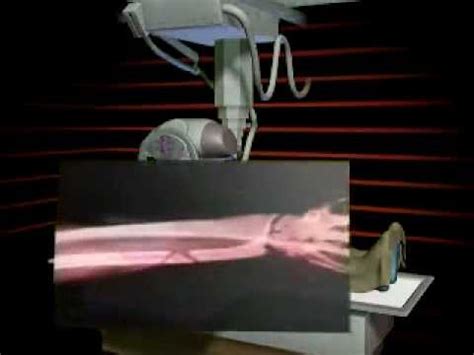 We did not find results for: How does an X-ray machine work? - YouTube