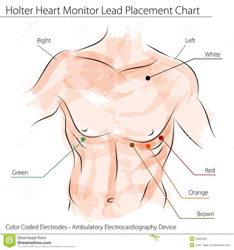 Holter Heart Monitor Lead Placement Chart Stock Vector