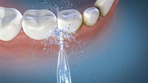 How Water Flossing Works Various Signs That Impacts The World