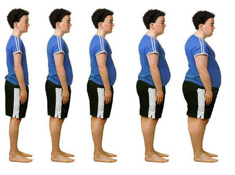 Calling Obesity A Disease Fat Acceptance Advocates Predict More Stigma