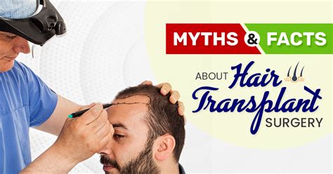 Myths And Facts About Hair Transplant Surgery Cosmed Clinic
