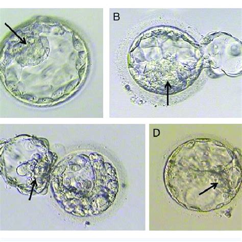 Examples Of Human Blastocyst Morphology Evaluation A High Quality