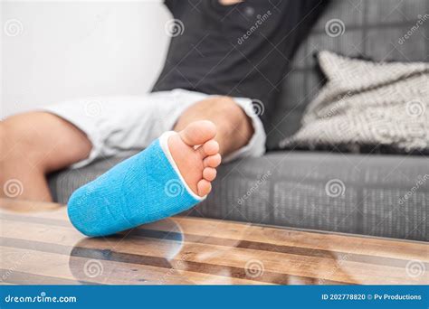 Close Up Of Male Foot In Plaster Cast With Blue Splint Stock Photo
