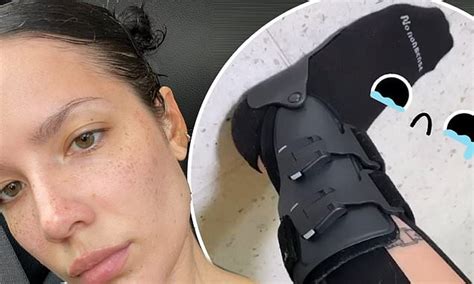 Halsey Shows Off Her Freckles In A Selfie After Showing Off Medical