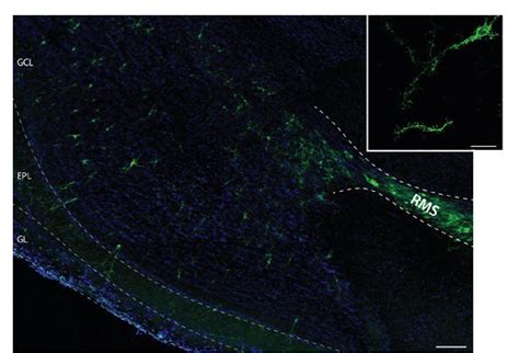 Figure From Selective Viral Transduction Of Adult Born Olfactory