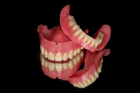 Boise Idaho Prosthodontics: Maxillary Complete Denture / Mandibular ...