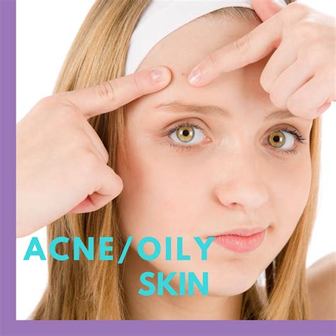Oil Control Acne Treatment For Teens Beauty Grace