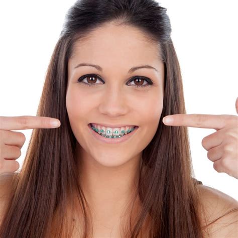 Orthodontics Mint Dental Dc