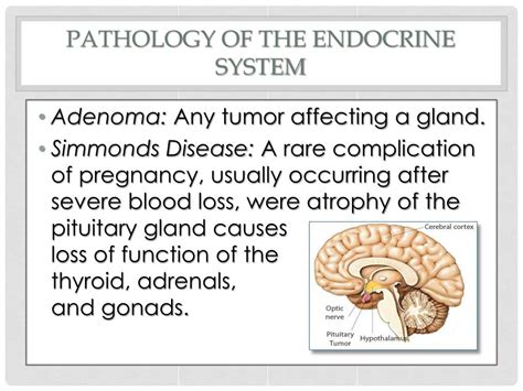 Ppt The Endocrine System Powerpoint Presentation Free Download Id