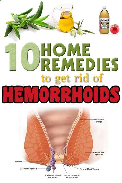 How To Naturally Get Rid Of Hemorrhoids 10 Home Remedies Getting