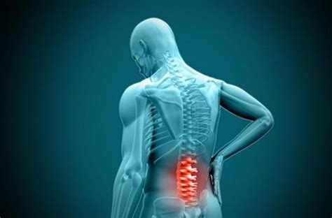 El Dolor Lumbar Síntomas Causas Y Tratamiento De La Lumbalgia O Lumbago