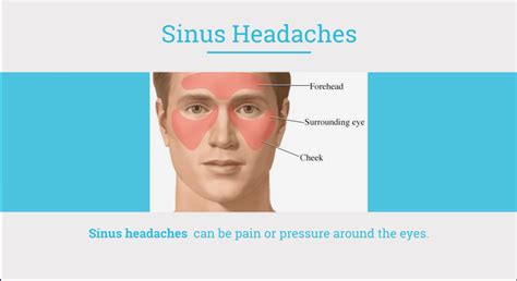 Media Room - South Texas Sinus Institute