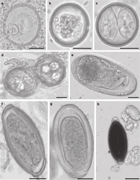 Cyst And Oocysts Of Protozoa And Nematode Eggs Found In Faecal Samples