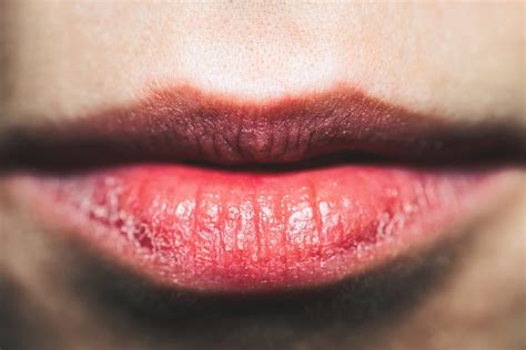10 Secrets To Getting Rid Of Dry Skin On Lips Bellatory