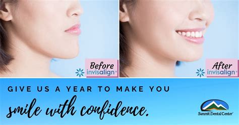 Maybe you would like to learn more about one of these? Summit Dental Center knows how to fix a crooked smile ...