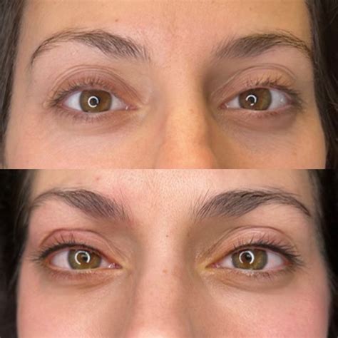 Eyelash Line Enhancement Permanent Makeup Room