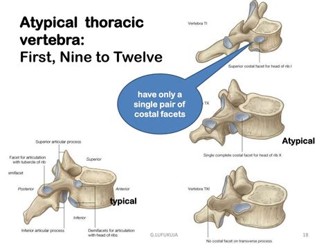 Difference Between Typical And Atypical Thoracic Vert