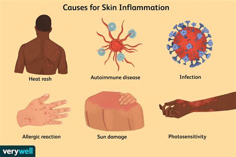 Skin Inflammation Causes And Treatments
