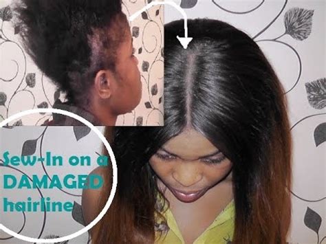 For example, keratin hair extensions, that one attaches with the help of melted hair protein (keratin). Sew-In on DAMAGED hairline - How I do it! - YouTube