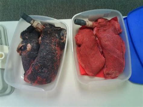 토토군 망가 동인지 일본 번역 망가 웹툰 애니망가 입니다. Bác sĩ sốc khi nhìn phổi đen như bồ hóng - Tin tức