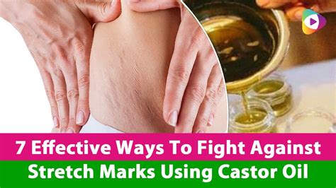 7 Effective Ways To Fight Against Stretch Marks Using Castor Oil