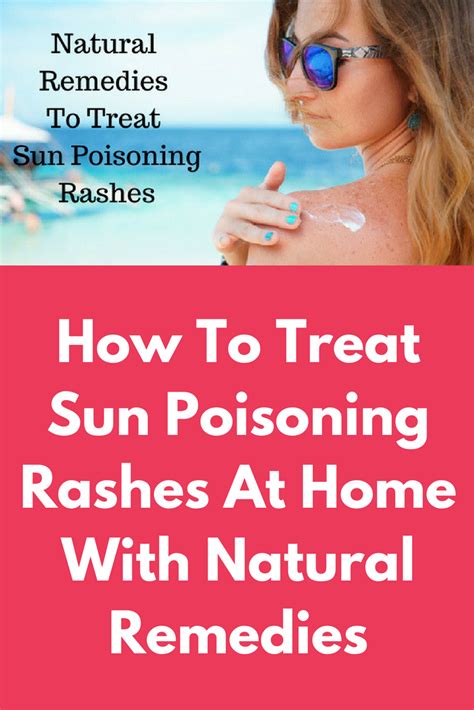 How To Treat Sun Poisoning Rashes At Home With Natural Remedies Sun