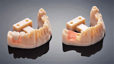 2021 Dental 3d Printing Guide All You Need To Know All3dp