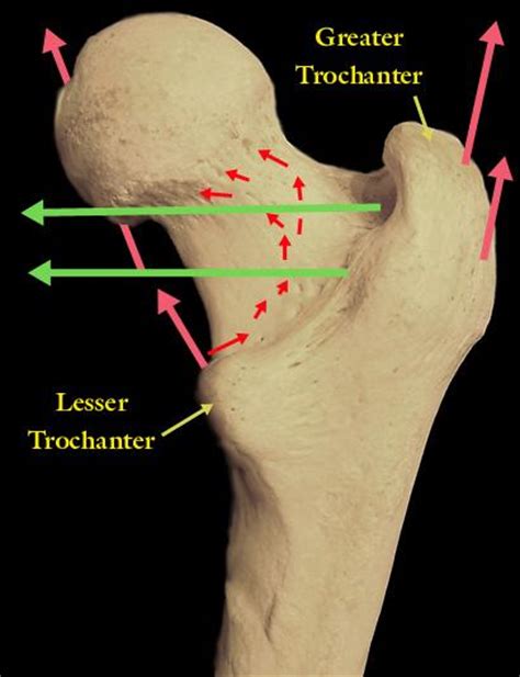 What does lesser trochanter mean? Bone Markings with Pictures - Occupational Therapy ...