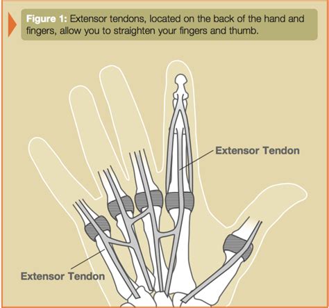 Primary Tendon Repair Of The Hand Extensor Index Long Ring Small
