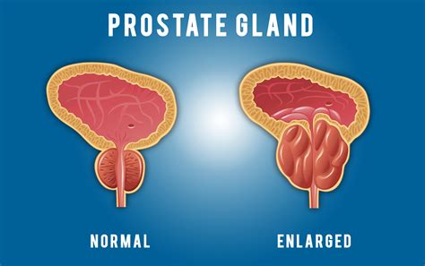Prostate Gland Structure
