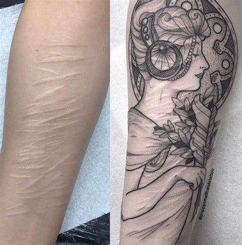 How To Cover Scars With Tattoos Others