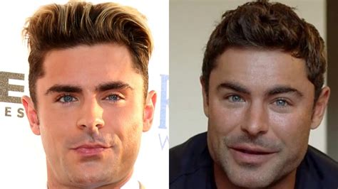 Zac Efron Reveals What Led To Plastic Surgery Rumors After Viral Photos