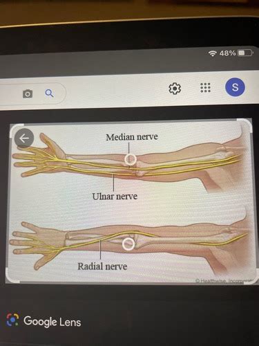 Hand Nerve Injuries Flashcards Quizlet