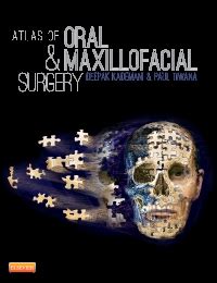 Atlas Of Oral And Maxillofacial Surgery Elsevier EBook On VitalSource