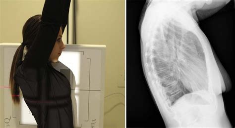 Radiographic Positioning Radiology Key