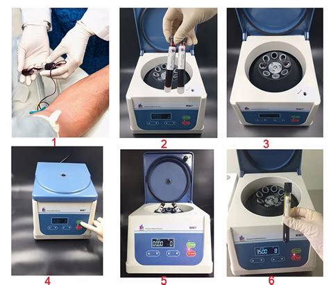Platelet Rich Plasma Centrifuga Prf Blood Prp Centrifuge Machine