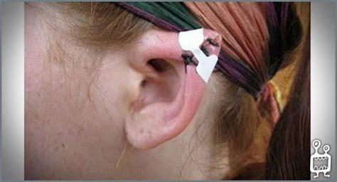 Body Modification Elf Ears Cost Please Tell Me This Is A Jokeright