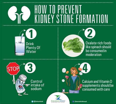 How Long Can Kidney Stone Pain Last