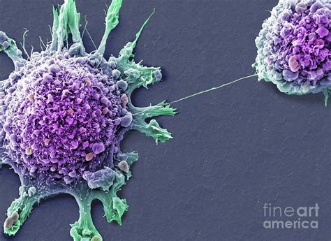 Breast Cancer Cells Photograph By Anne Weston Francis Crick Institute