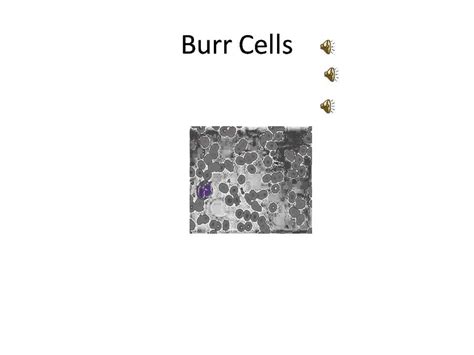 Evaluation Of Cell Morphology And Introduction To Platelet Youtube