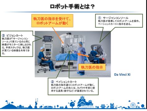 食道がんと胃がんのロボット支援下手術の最前線：がんナビ