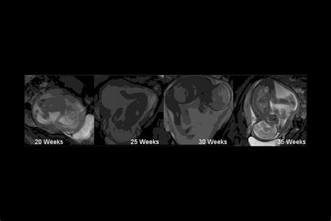 Some people recommend moving into certain positions, taking herbal medicines, and doing particular exercises to help babies in breech turn to the. Why Do Babies Kick in the Womb?