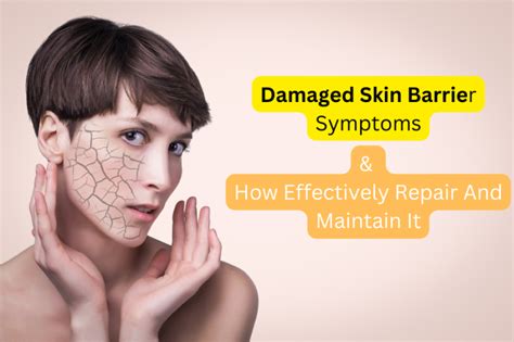 Damaged Skin Barrier Symptoms And How To Repair It