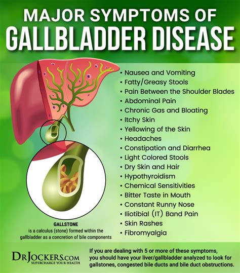 Bile Flow Top 15 Herbs To Support Liver And Gallbladder